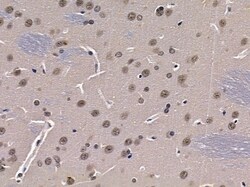 Invitrogen NY-BR-1 Polyclonal Antibody 100 &mu;L; Unconjugated:Antibodies,