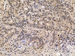 Invitrogen NY-BR-1 Polyclonal Antibody 100 &mu;L; Unconjugated:Antibodies,
