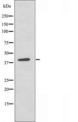 Invitrogen PRDM12 Polyclonal Antibody 100 &mu;L; Unconjugated:Antibodies,