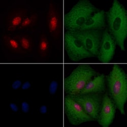 Invitrogen BRMS1 Polyclonal Antibody 100 &mu;L; Unconjugated:Antibodies,