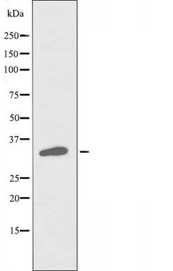 Invitrogen DNAJC17 Polyclonal Antibody 100 &mu;L; Unconjugated:Antibodies,