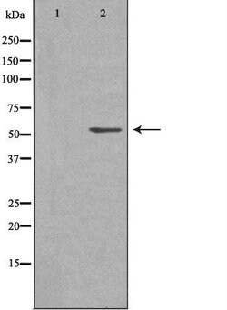 Invitrogen CARKL Polyclonal Antibody 100 &mu;L; Unconjugated:Antibodies,