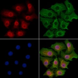 Invitrogen CNOT7 Polyclonal Antibody 100 &mu;L; Unconjugated:Antibodies,