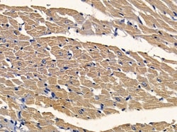 Invitrogen JIP3 Polyclonal Antibody 100 &mu;L; Unconjugated:Antibodies,