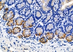 Adenylate Cyclase 4 Polyclonal Antibody:Antibodies, Polyclonal