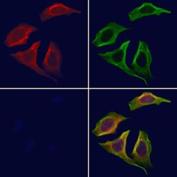Adenylate Cyclase 4 Polyclonal Antibody:Antibodies, Polyclonal