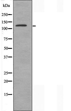 Invitrogen Adenylate Cyclase 5/6 Polyclonal Antibody 100 &mu;L; Unconjugated:Antibodies,