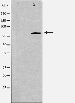 Invitrogen CDH22 Polyclonal Antibody 100 &mu;L; Unconjugated:Antibodies,