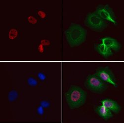 Invitrogen CDCA7 Polyclonal Antibody 100 &mu;L; Unconjugated:Antibodies,