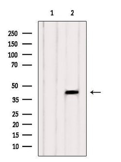 Invitrogen CDCA7 Polyclonal Antibody 100 &mu;L; Unconjugated:Antibodies,