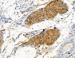 Invitrogen COL20A1 Polyclonal Antibody 100 &mu;L; Unconjugated:Antibodies,
