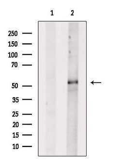 CYP21A2 Polyclonal Antibody:Antibodies, Polyclonal