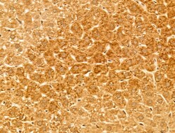 Invitrogen CYP27A1 Polyclonal Antibody 100 &mu;L | Buy Online | Invitrogen&trade; | Fisher Scientific