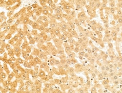 Invitrogen CYP27A1 Polyclonal Antibody 100 &mu;L | Buy Online | Invitrogen&trade; | Fisher Scientific