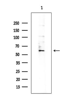Invitrogen CYP27A1 Polyclonal Antibody 100 &mu;L | Buy Online | Invitrogen&trade; | Fisher Scientific