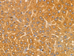 Invitrogen CYP2A13 Polyclonal Antibody 100 &mu;L; Unconjugated:Antibodies,