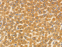 Invitrogen CYP2A13 Polyclonal Antibody 100 &mu;L; Unconjugated:Antibodies,