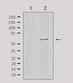 Invitrogen CYP2A13 Polyclonal Antibody 100 &mu;L; Unconjugated:Antibodies,