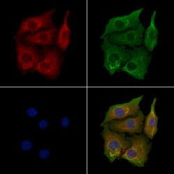 Invitrogen CYP2R1 Polyclonal Antibody 100 &mu;L; Unconjugated:Antibodies,