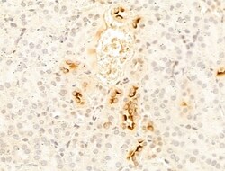 Invitrogen CYP2R1 Polyclonal Antibody 100 &mu;L; Unconjugated:Antibodies,