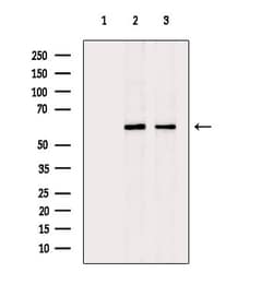 Invitrogen CYP2R1 Polyclonal Antibody 100 &mu;L; Unconjugated:Antibodies,
