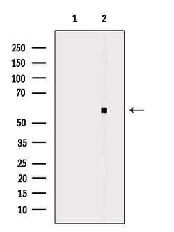 Invitrogen CYP2W1 Polyclonal Antibody 100 &mu;L; Unconjugated:Antibodies,