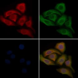Invitrogen CYP3A43 Polyclonal Antibody 100 &mu;L | Buy Online | Invitrogen&trade; | Fisher Scientific