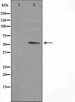 Invitrogen CYP3A43 Polyclonal Antibody 100 &mu;L | Buy Online | Invitrogen&trade; | Fisher Scientific