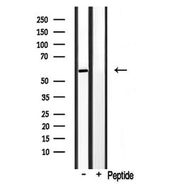 Invitrogen CYP3A4/CYP3A5 Polyclonal Antibody 100 &mu;L; Unconjugated:Antibodies,