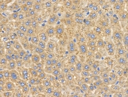 Invitrogen CYP4X1 Polyclonal Antibody 100 &mu;L | Buy Online | Invitrogen&trade; | Fisher Scientific