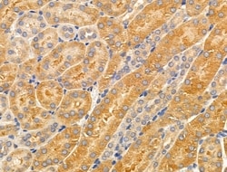 Invitrogen CYP4X1 Polyclonal Antibody 100 &mu;L | Buy Online | Invitrogen&trade; | Fisher Scientific