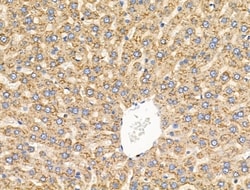 Invitrogen CYP4X1 Polyclonal Antibody 100 &mu;L | Buy Online | Invitrogen&trade; | Fisher Scientific