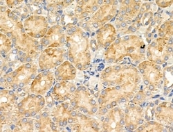 Invitrogen CYP4X1 Polyclonal Antibody 100 &mu;L | Buy Online | Invitrogen&trade; | Fisher Scientific
