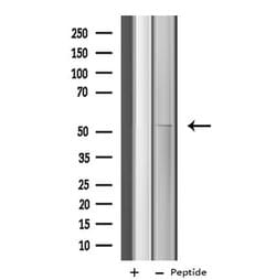 Invitrogen CYP4X1 Polyclonal Antibody 100 &mu;L | Buy Online | Invitrogen&trade; | Fisher Scientific
