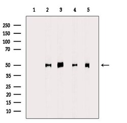 Invitrogen CYP4X1 Polyclonal Antibody 100 &mu;L | Buy Online | Invitrogen&trade; | Fisher Scientific