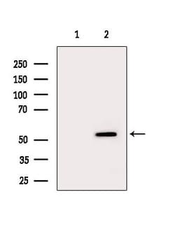 Invitrogen CYP4X1 Polyclonal Antibody 100 &mu;L | Buy Online | Invitrogen&trade; | Fisher Scientific