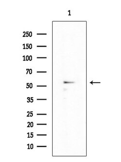 Invitrogen CYP4X1 Polyclonal Antibody 100 &mu;L | Buy Online | Invitrogen&trade; | Fisher Scientific