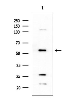 Invitrogen CYP4X1 Polyclonal Antibody 100 &mu;L | Buy Online | Invitrogen&trade; | Fisher Scientific