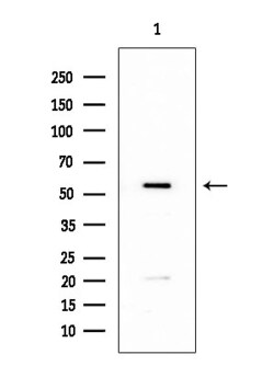 Invitrogen CYP4X1 Polyclonal Antibody 100 &mu;L | Buy Online | Invitrogen&trade; | Fisher Scientific
