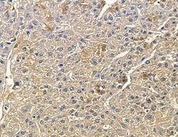 Invitrogen CYP7B1 Polyclonal Antibody 100 &mu;L; Unconjugated:Antibodies,