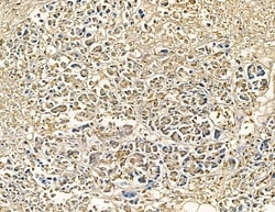Invitrogen CYP7B1 Polyclonal Antibody 100 &mu;L; Unconjugated:Antibodies,