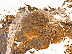 Invitrogen FGF23 Polyclonal Antibody 100 &mu;L; Unconjugated:Antibodies,