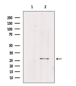 Invitrogen FGF23 Polyclonal Antibody 100 &mu;L; Unconjugated:Antibodies,