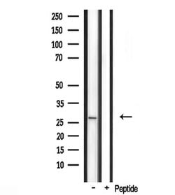Invitrogen FGF23 Polyclonal Antibody 100 &mu;L; Unconjugated:Antibodies,