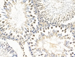 Invitrogen EXO1 Polyclonal Antibody 100 &mu;L; Unconjugated:Antibodies,