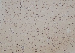 Invitrogen RAD51B Polyclonal Antibody 100 &mu;L; Unconjugated:Antibodies,