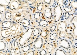 Invitrogen AGPAT3 Polyclonal Antibody 100 &mu;L; Unconjugated:Antibodies,