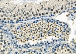 Invitrogen AGPAT3 Polyclonal Antibody 100 &mu;L; Unconjugated:Antibodies,