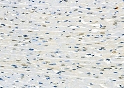 Invitrogen AGPAT3 Polyclonal Antibody 100 &mu;L; Unconjugated:Antibodies,