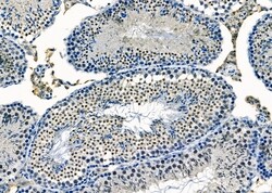 Invitrogen AGPAT3 Polyclonal Antibody 100 &mu;L; Unconjugated:Antibodies,